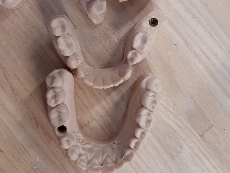 Réparation de dentier à Jodoigne